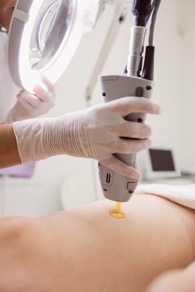 Close up of doctor performing laser hair removal on female patient skin in clinic